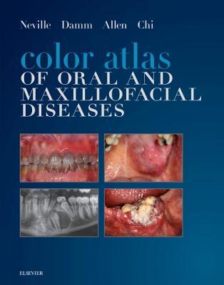 Read Color Atlas of Oral and Maxillofacial Diseases - Brad W. Neville | ePub